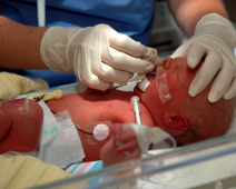 Infant procedure