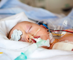 Newborn in hospital with monitors